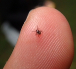 קדחת הבהרות: מחלה קיצית-תמונה